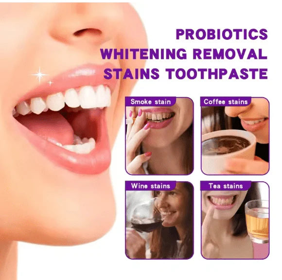 Deep Clean Whitening Toothpaste – Enamel-Safe Stain Remover (120g)