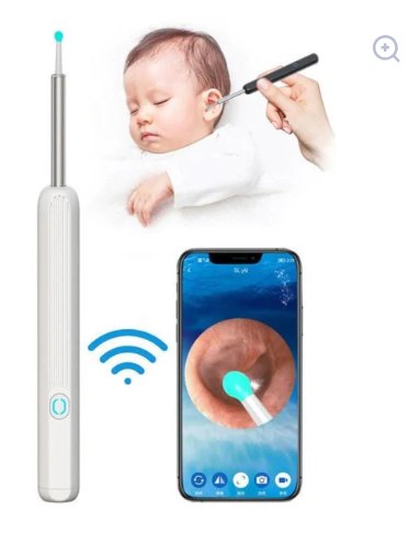 Earwax Removal Kit – Smart Visual Ear Cleaning Tool with HD Camera & Wi-Fi