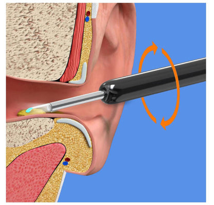 Earwax Removal Kit – Smart Visual Ear Cleaning Tool with HD Camera & Wi-Fi