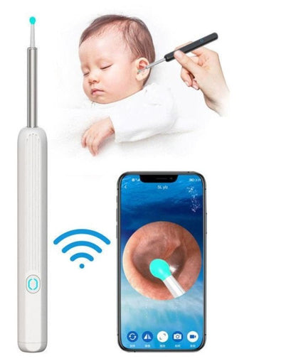 Earwax Removal Kit – Smart Visual Ear Cleaning Tool with HD Camera & Wi-Fi