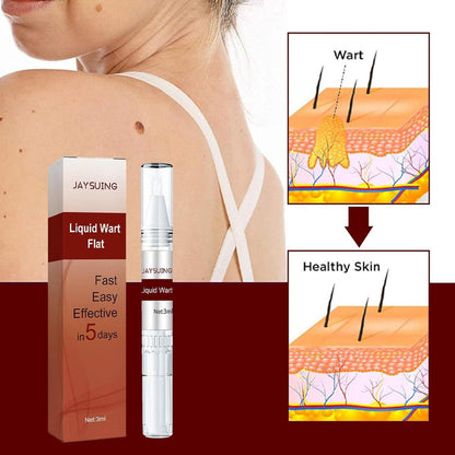 JAYSUING Wart & Skin Tag Remover Liquid – Fast 5-Day Formula, 30ml