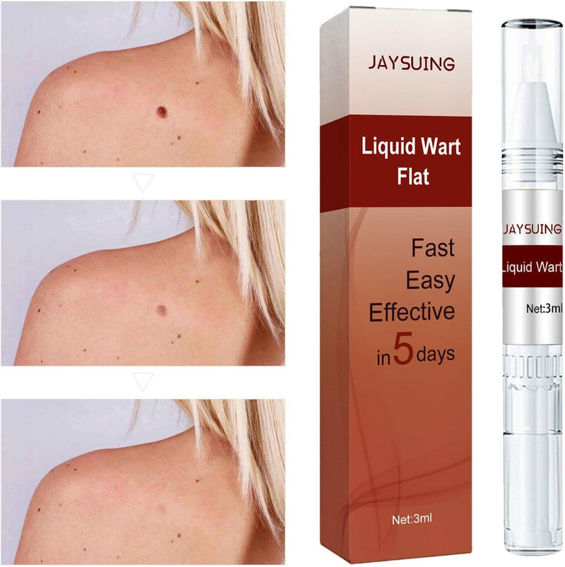 JAYSUING Wart & Skin Tag Remover Liquid – Fast 5-Day Formula, 30ml