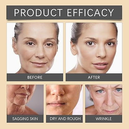 OUHOE Bee Venom Botox Wrinkle Cream – Anti-Aging & Firming Treatment