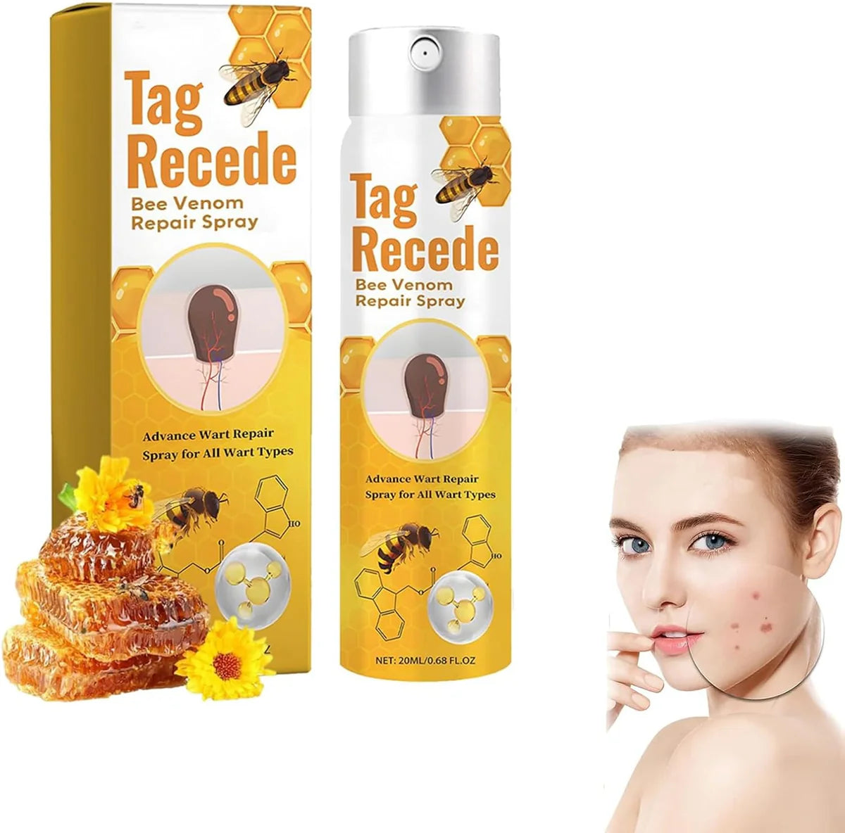 Tag Recede Bee Venom Repair Spray – Advanced Wart & Skin Tag Treatment