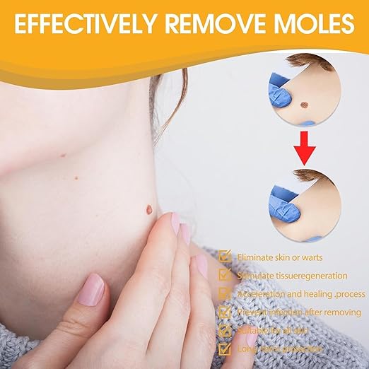 Tag Recede Bee Venom Repair Spray – Advanced Wart & Skin Tag Treatment