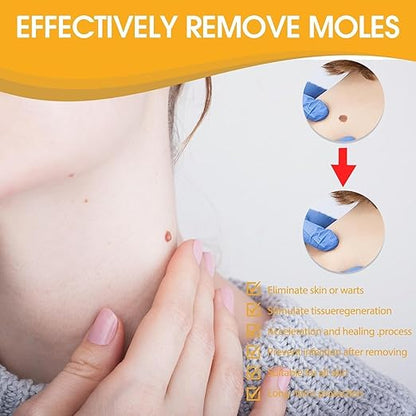 Tag Recede Bee Venom Repair Spray – Advanced Wart & Skin Tag Treatment