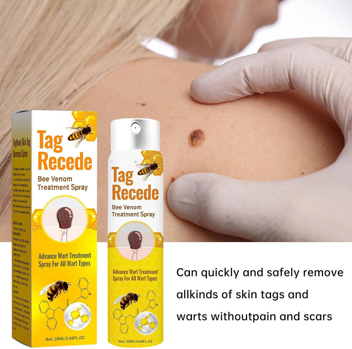 Tag Recede Bee Venom Repair Spray – Advanced Wart & Skin Tag Treatment